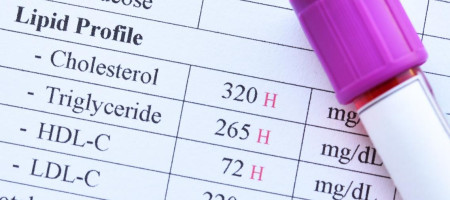 Riconoscere e prevenire le dislipidemie